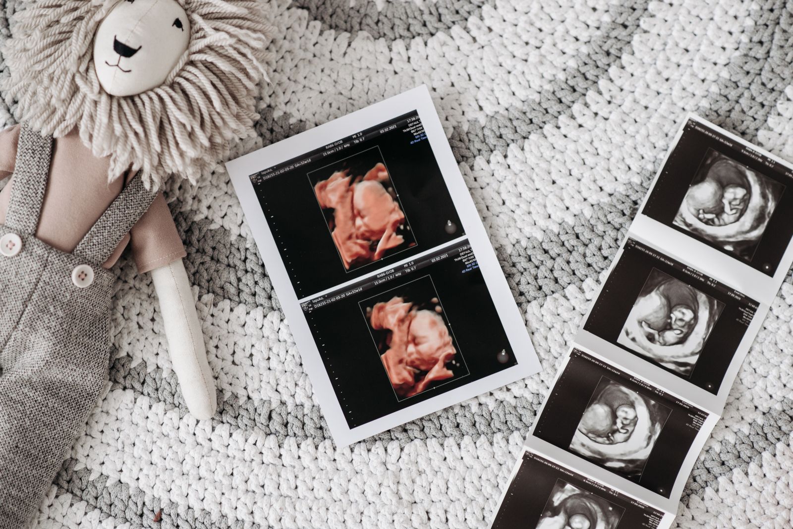 ultrasound photos on rug